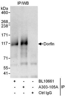 Detection of human Dorfin by western blot of immunoprecipitates.