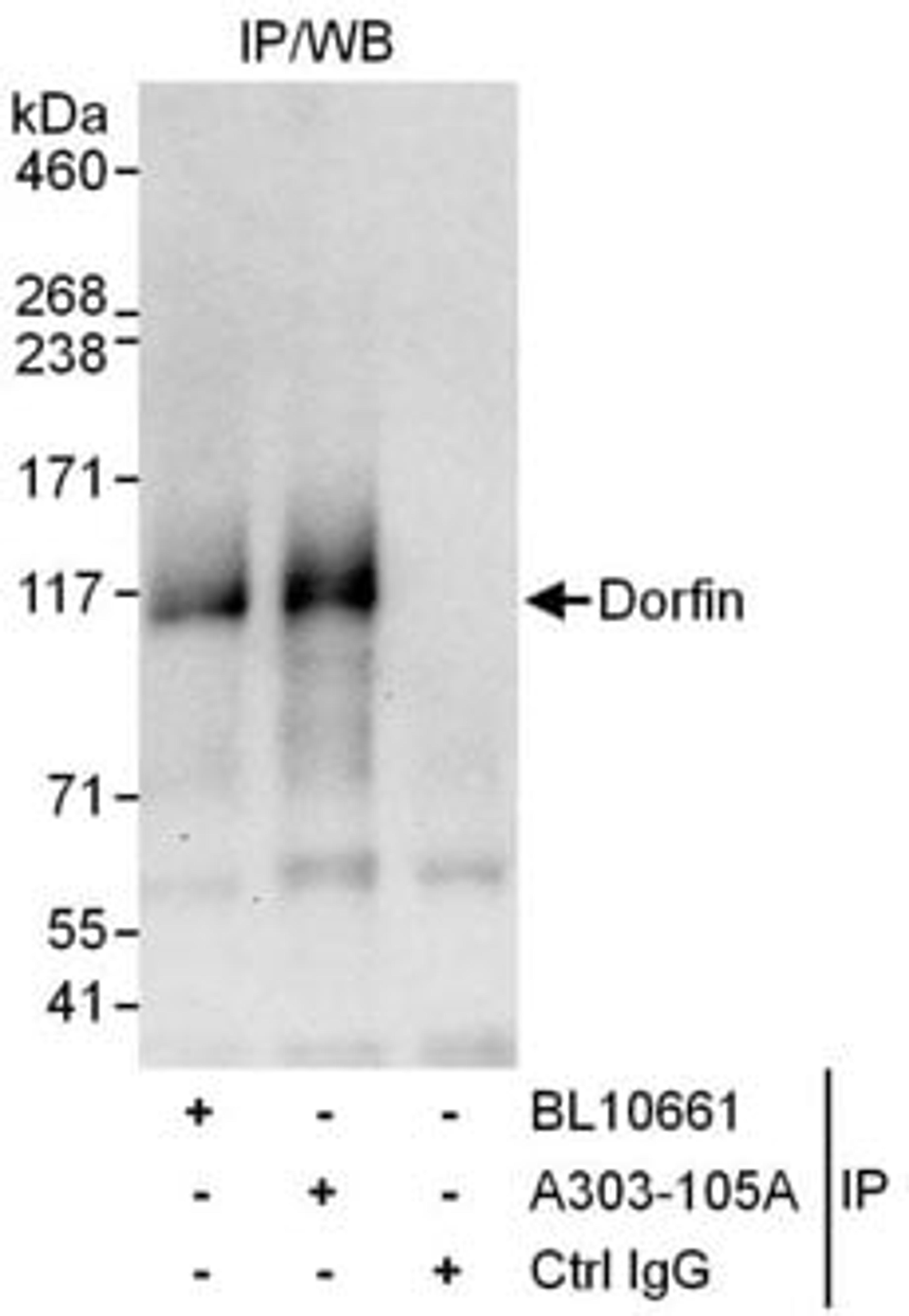 Detection of human Dorfin by western blot of immunoprecipitates.