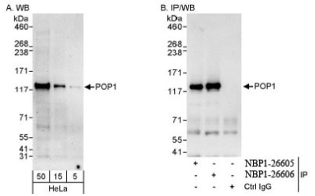 Western Blot: POP1 Antibody [NBP1-26605] - Whole cell lysate from HeLa cells. POP1 was also immunoprecipitated by rabbit anti-POP1 antibody NBP1-26606.