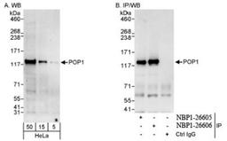 Western Blot: POP1 Antibody [NBP1-26605] - Whole cell lysate from HeLa cells. POP1 was also immunoprecipitated by rabbit anti-POP1 antibody NBP1-26606.