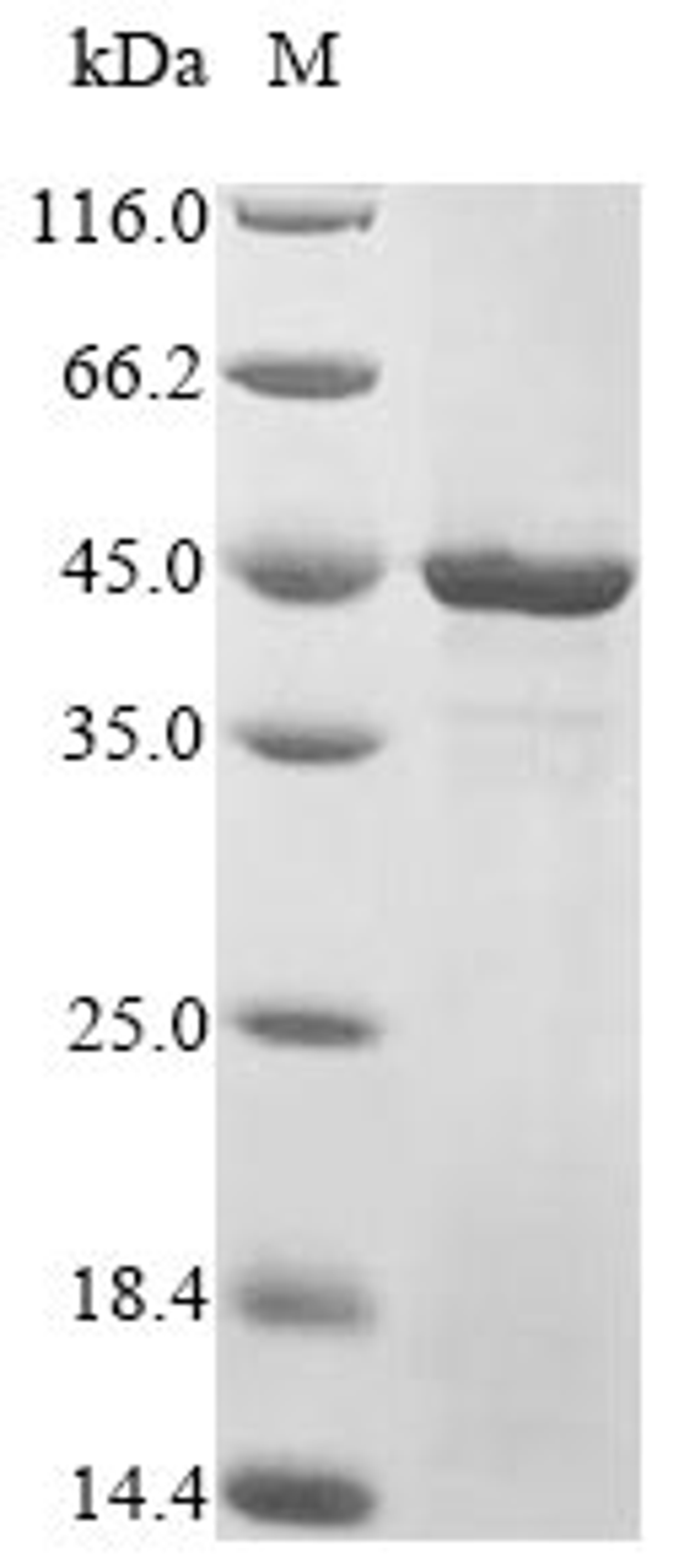 (Tris-Glycine gel) Discontinuous SDS-PAGE (reduced) with 5% enrichment gel and 15% separation gel.