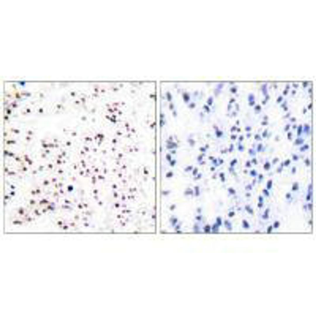 Immunohistochemical analysis of paraffin-embedded human tonsil tissue using MCM5 antibody.