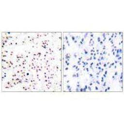 Immunohistochemical analysis of paraffin-embedded human tonsil tissue using MCM5 antibody.