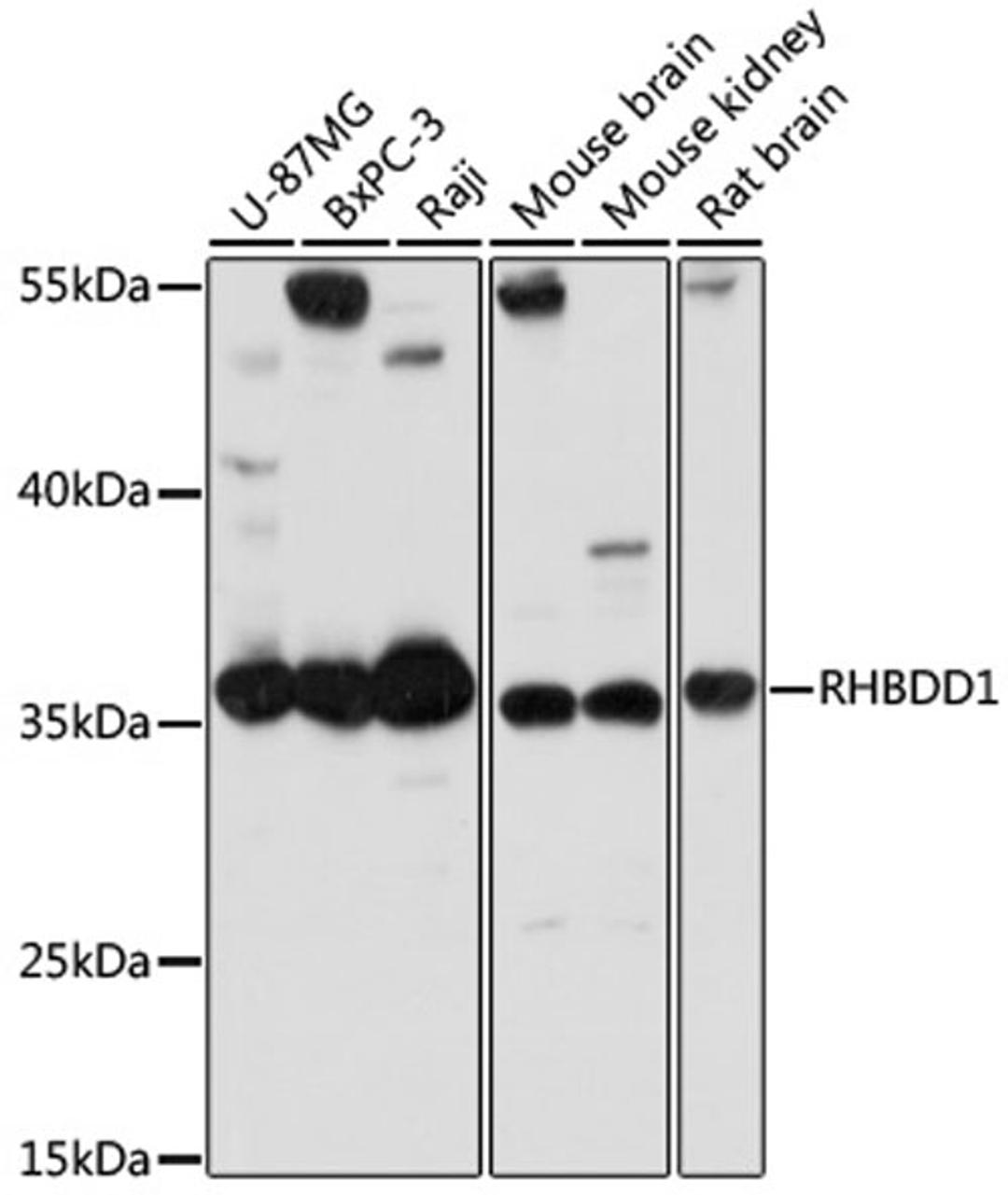 Western blot - RHBDD1 antibody (A14350)