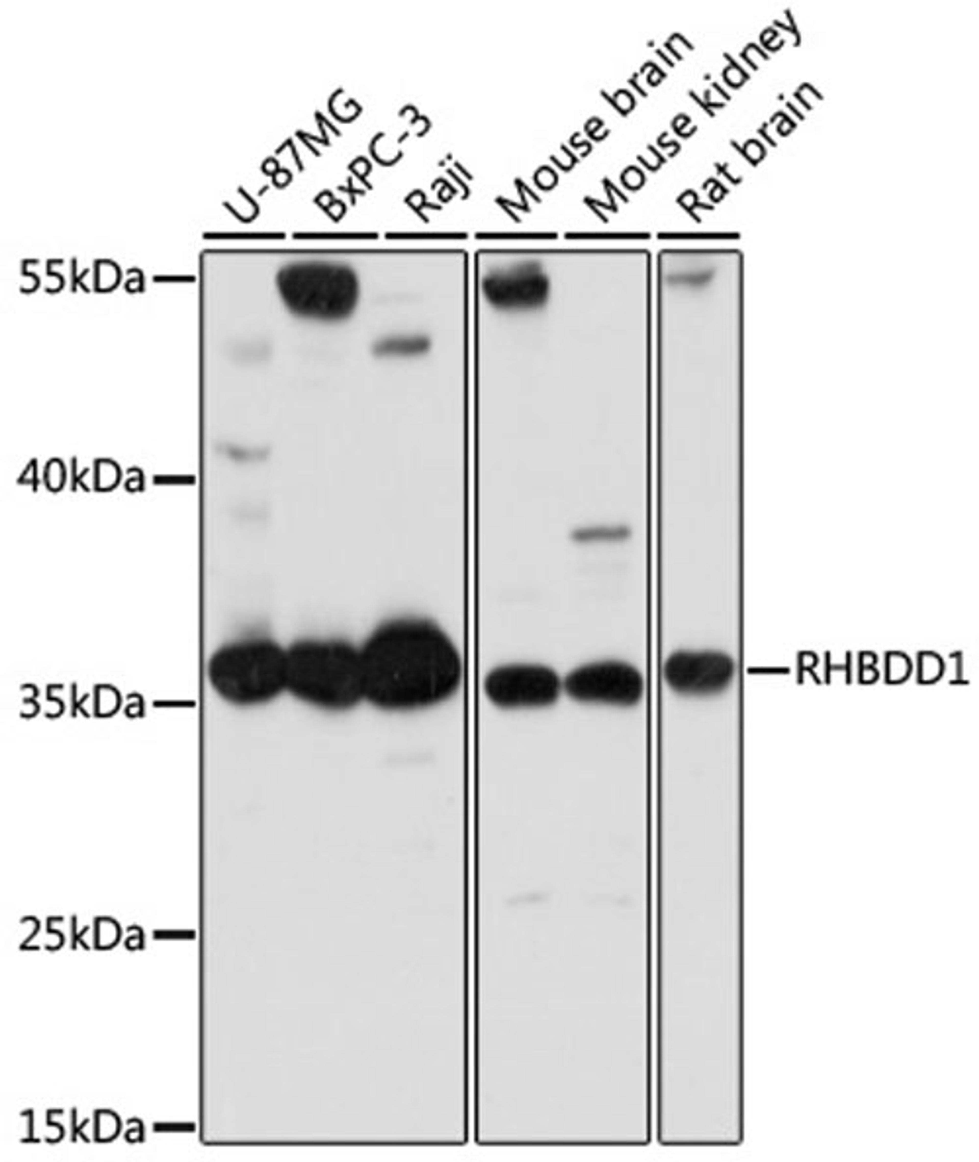 Western blot - RHBDD1 antibody (A14350)