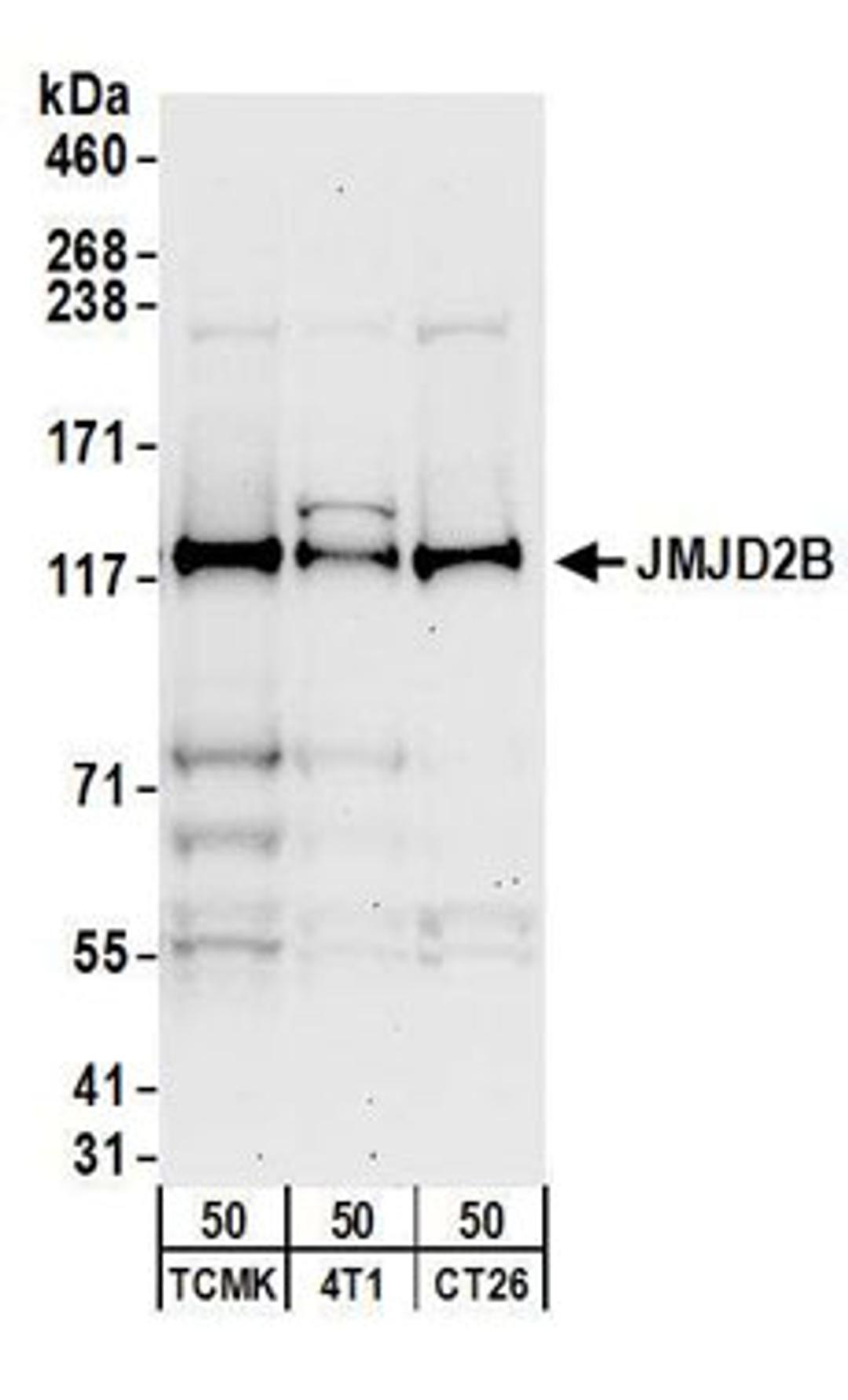 Detection of mouse JMJD2B by western blot.