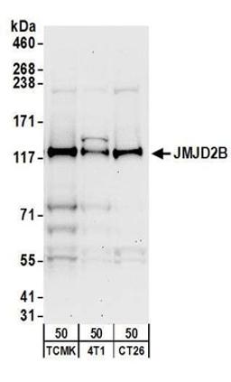 Detection of mouse JMJD2B by western blot.