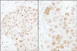 Detection of human and mouse CPSF73 by immunohistochemistry.