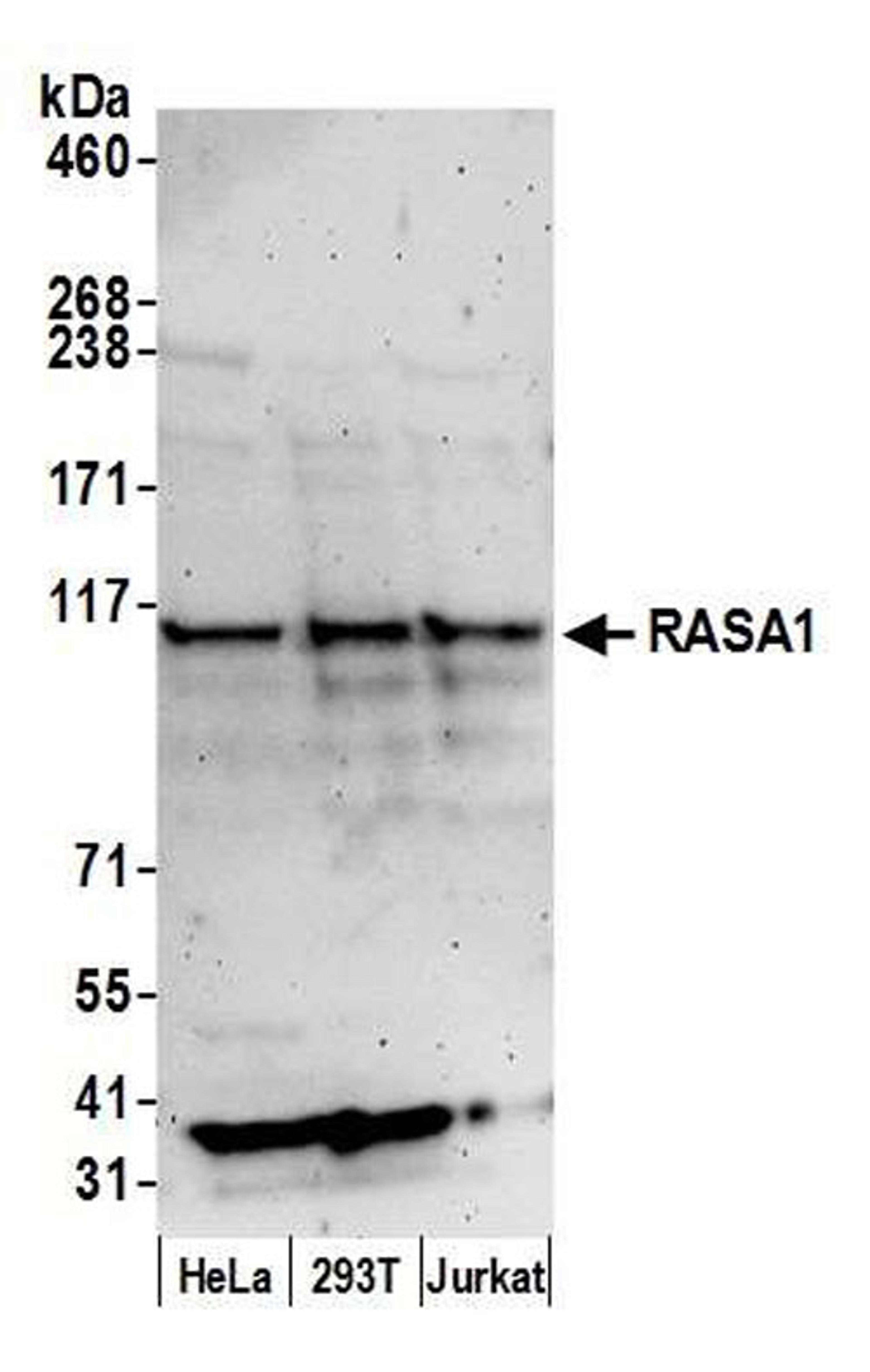 Detection of human RASA1 by WB.