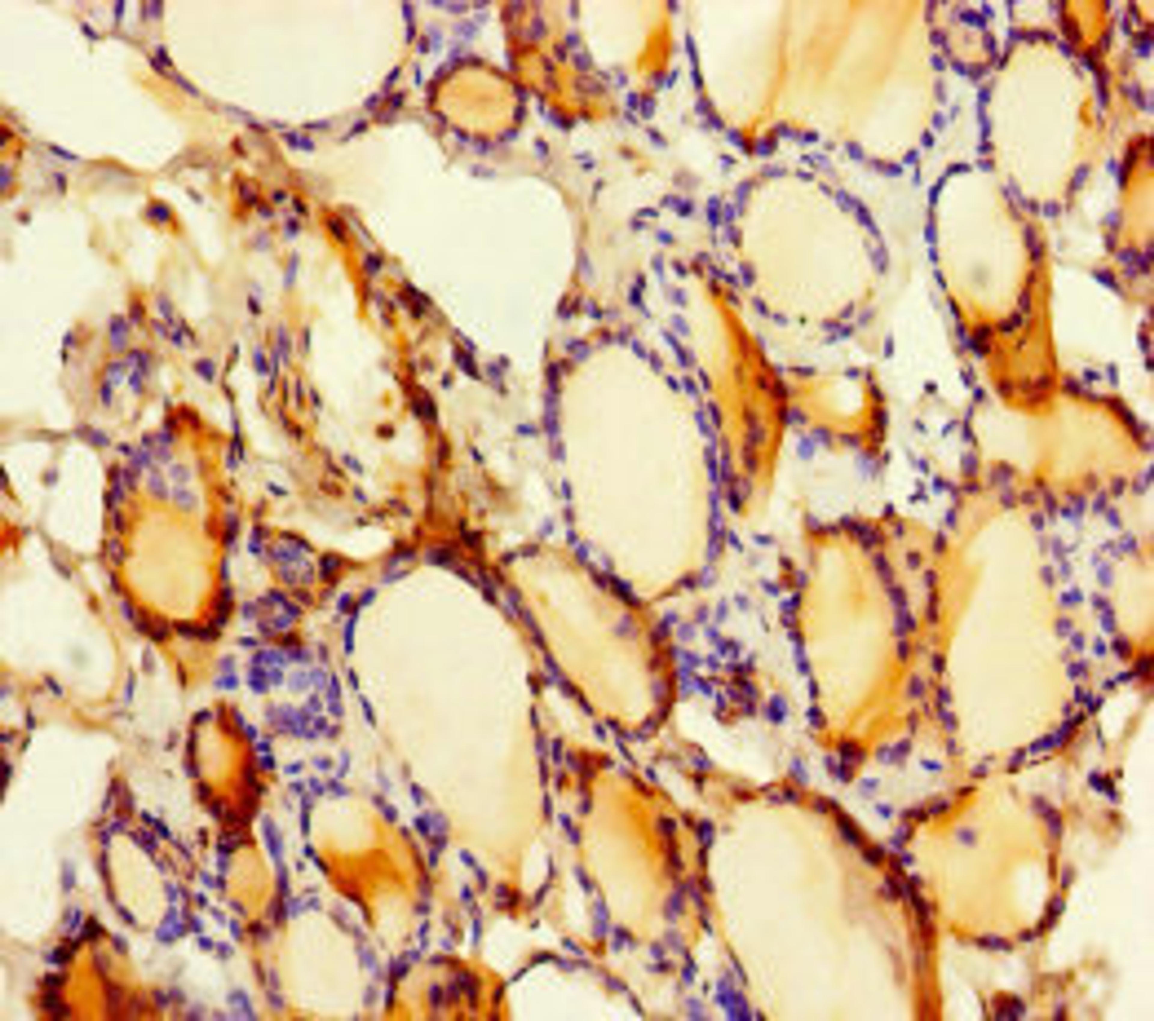 Immunohistochemistry of paraffin-embedded human thyroid tissue using CSB-PA867155LA01HU at dilution of 1:100