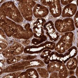 Immunohistochemistry-Paraffin: GBE1 Antibody [NBP1-85875] - Staining of human kidney shows strong cytoplasmic positivity in cells in tubule.