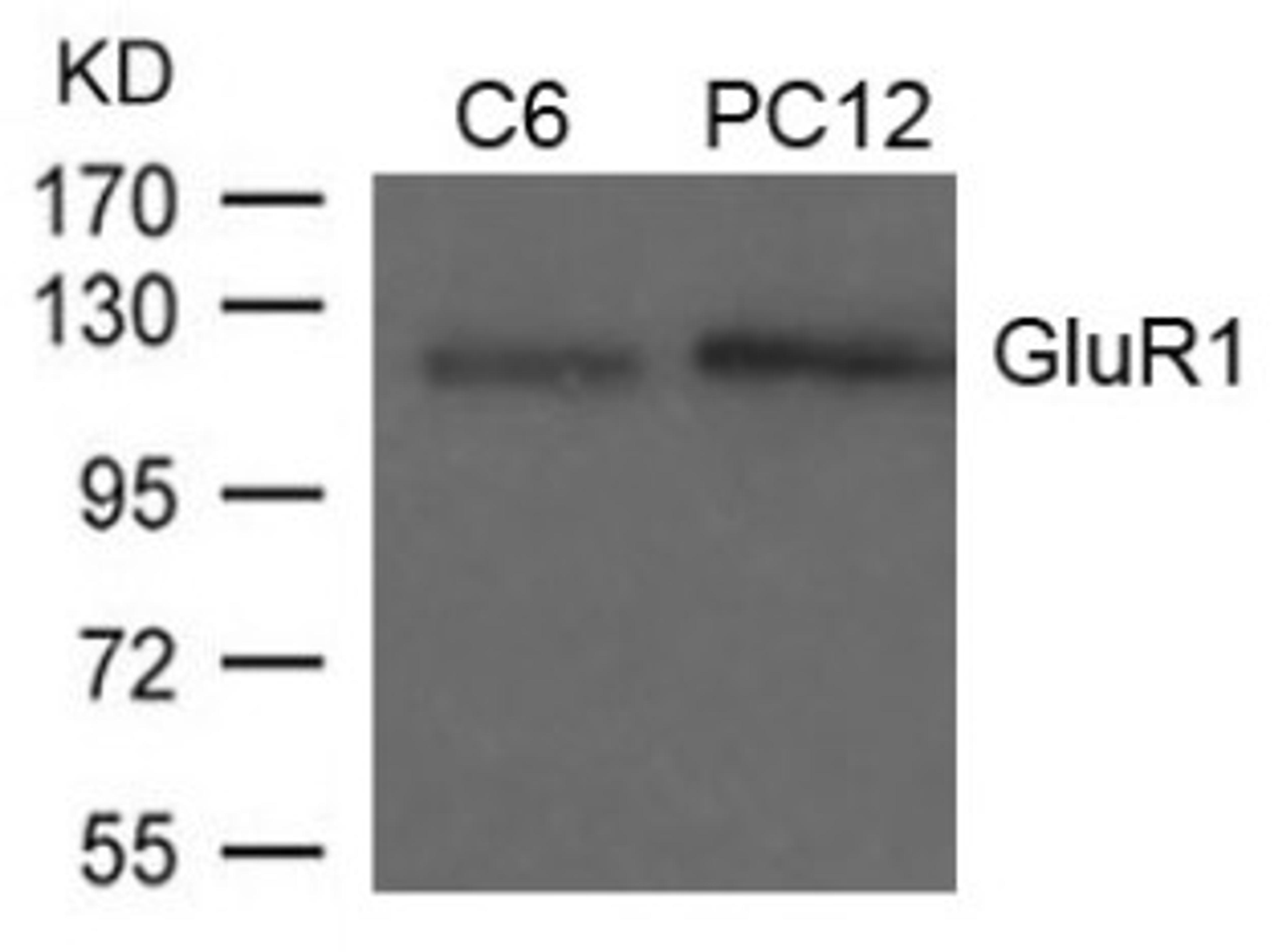 Western blot analysis of lysed extracts from C6 and PC12 cells using GluR1 (Ab-849).