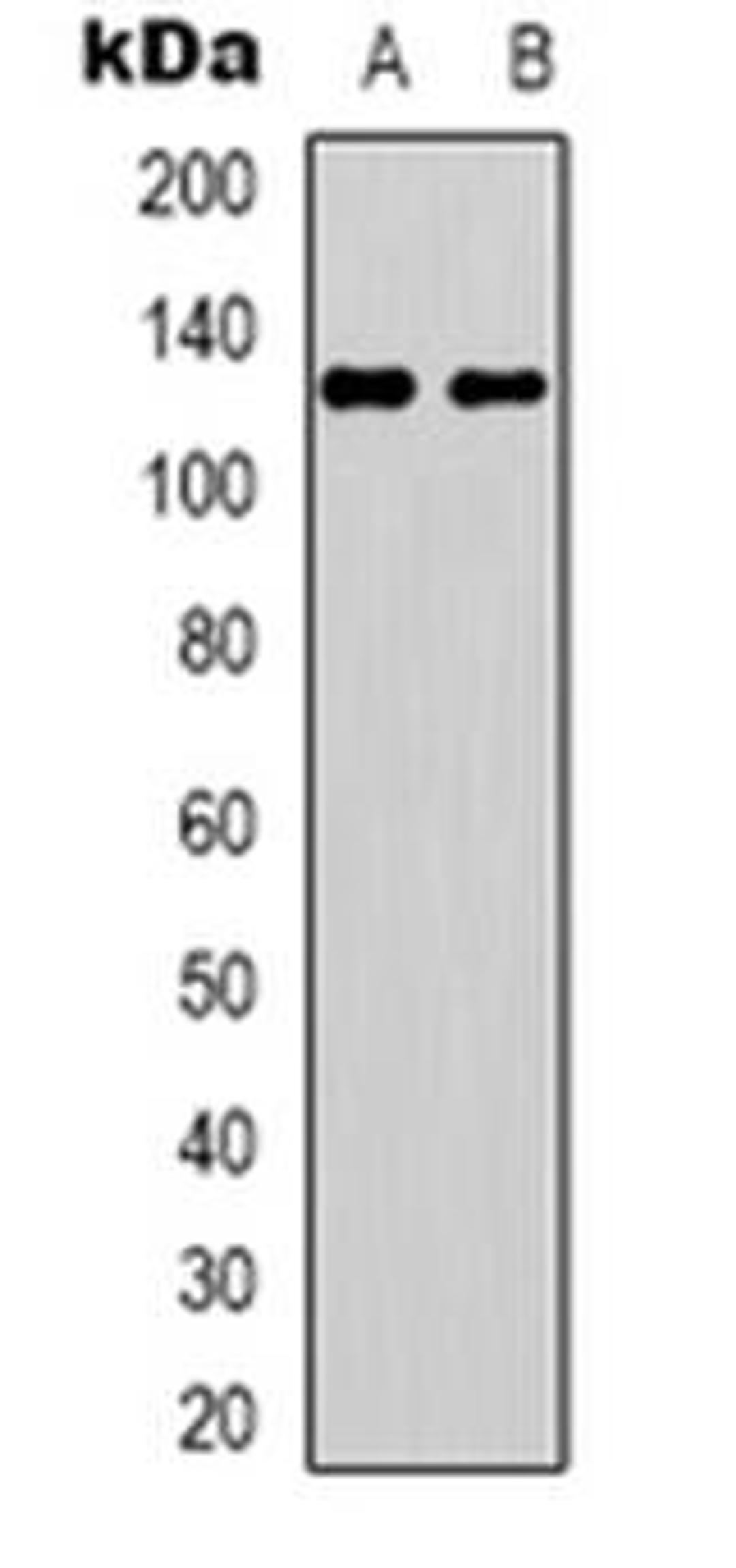 Western blot analysis of UBE3B expression in HEK293T (Lane 1), Jurkat (Lane 2) whole cell lysates using UBE3B antibody