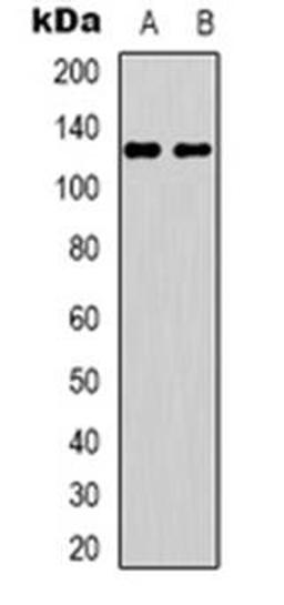 Western blot analysis of UBE3B expression in HEK293T (Lane 1), Jurkat (Lane 2) whole cell lysates using UBE3B antibody