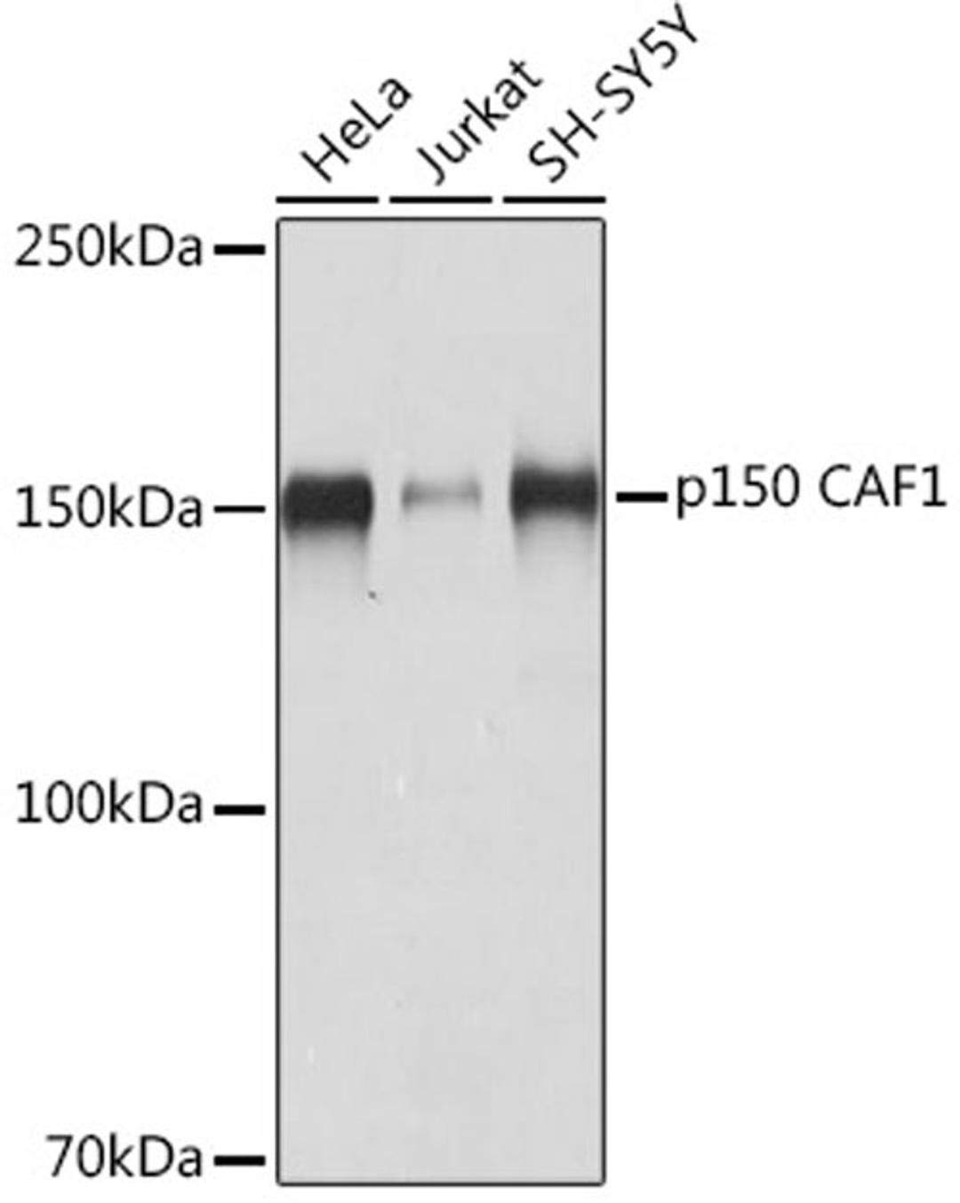 Western blot - p150 CAF1 Rabbit mAb (A8725)