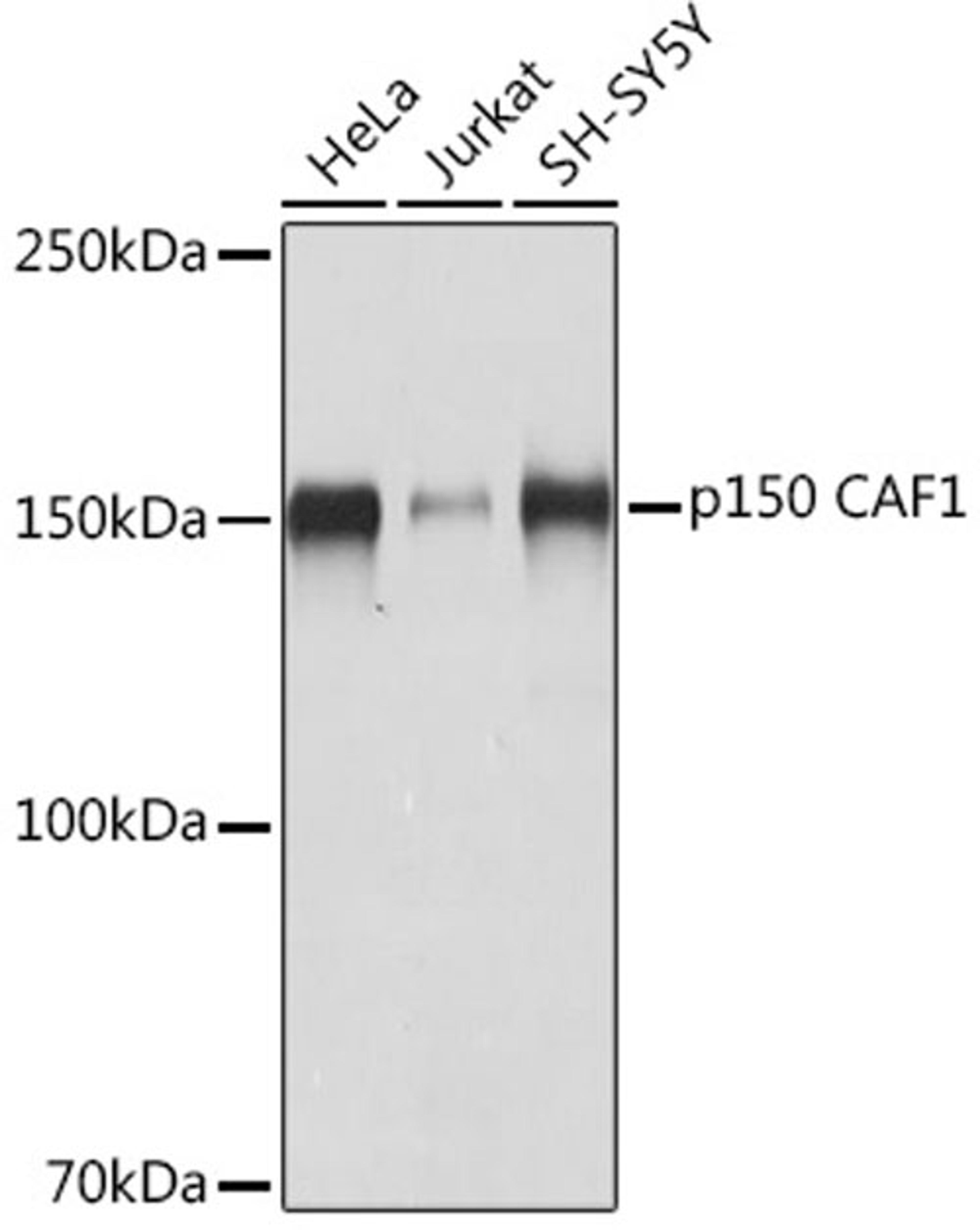 Western blot - p150 CAF1 Rabbit mAb (A8725)