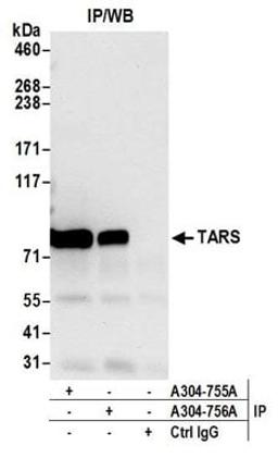 Detection of human TARS by western blot of immunoprecipitates.