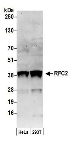 Detection of human RFC2 by western blot.