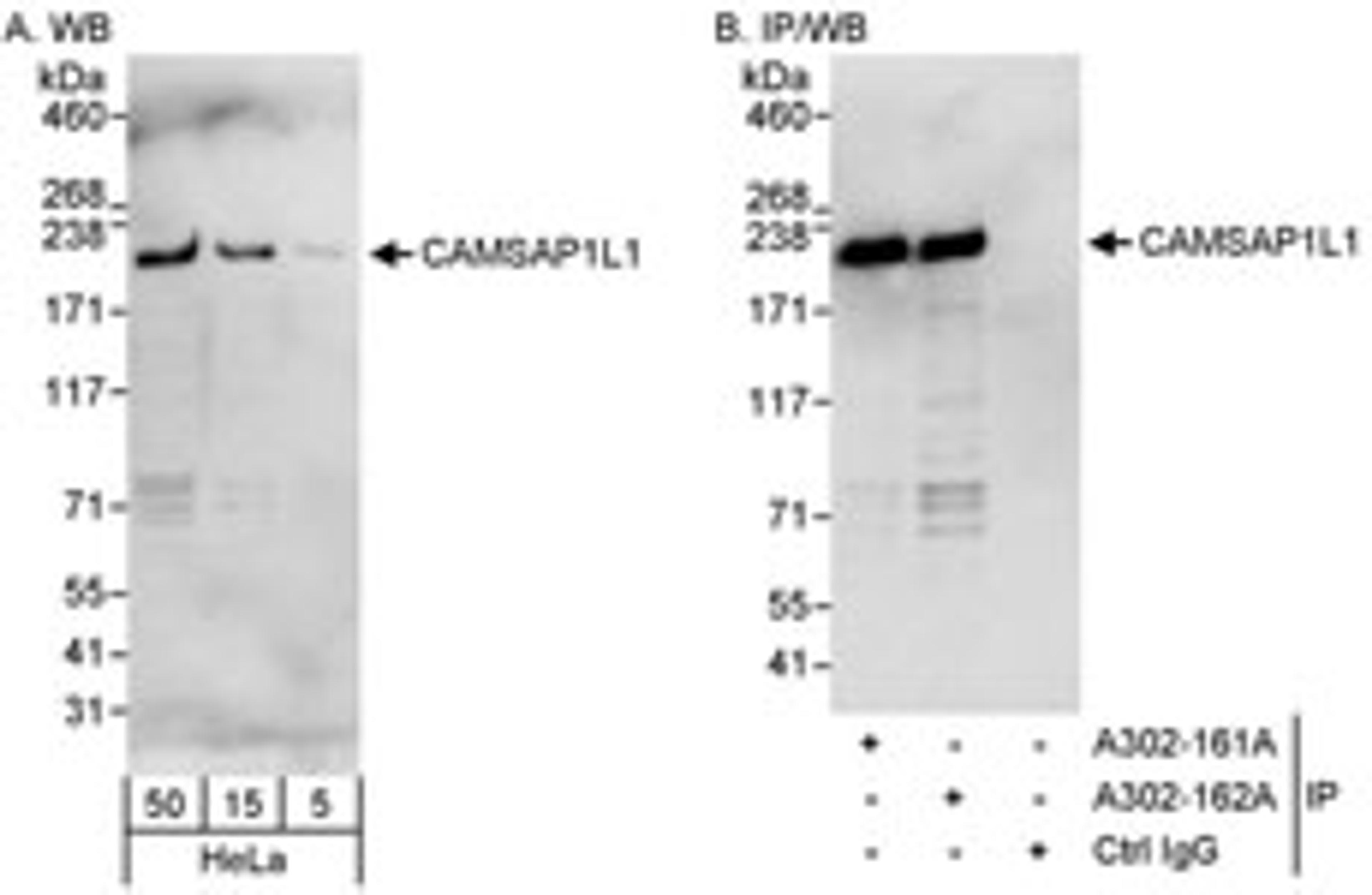 Detection of human CAMSAP1L1 by western blot and immunoprecipitation.