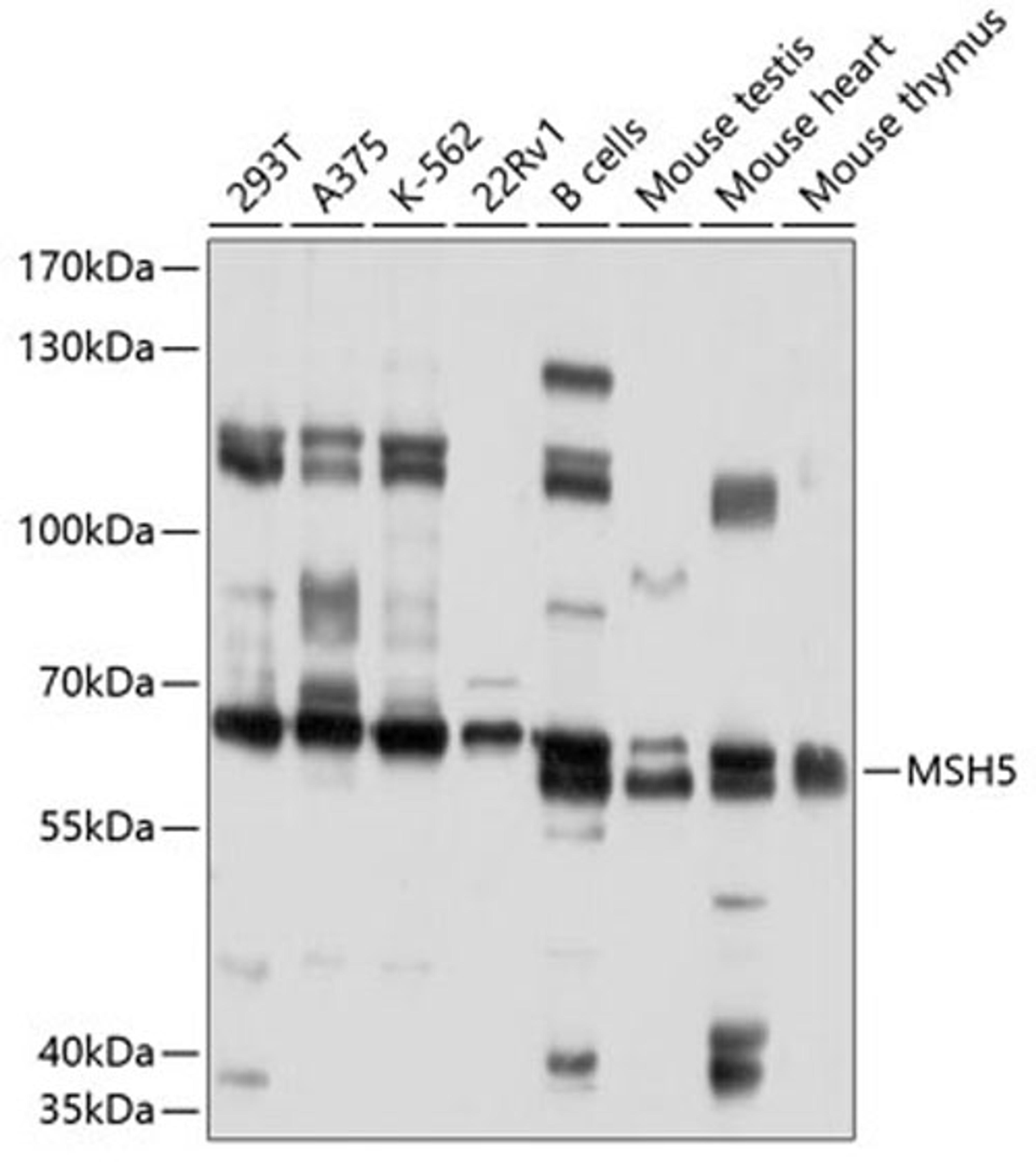 Western blot - MSH5 antibody (A10121)