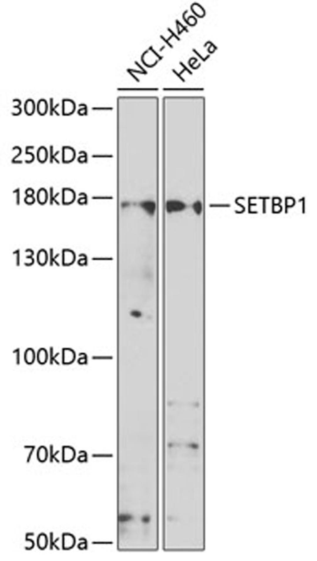 Western blot - SETBP1 antibody (A7212)