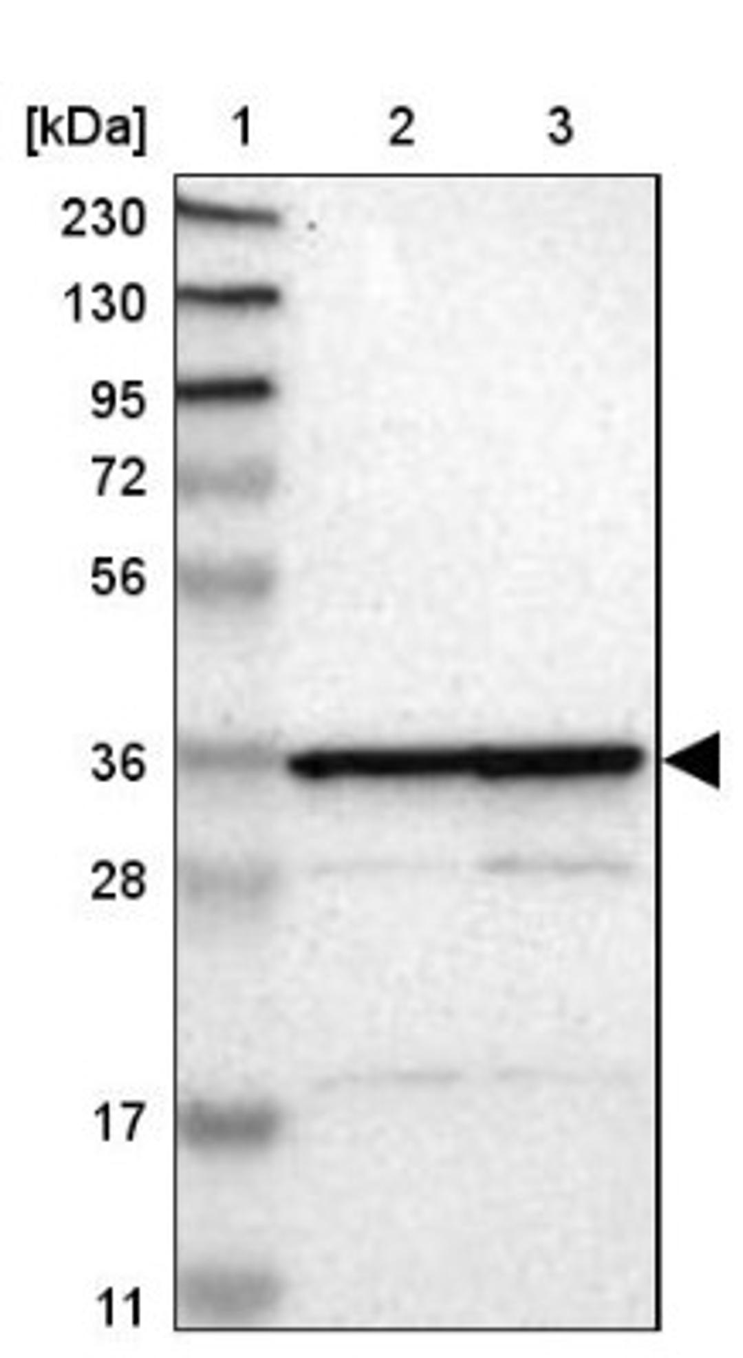 Western Blot: MRPL2 Antibody [NBP1-84513] - Lane 1: Marker [kDa] 230, 130, 95, 72, 56, 36, 28, 17, 11<br/>Lane 2: Human cell line RT-4<br/>Lane 3: Human cell line U-251MG sp