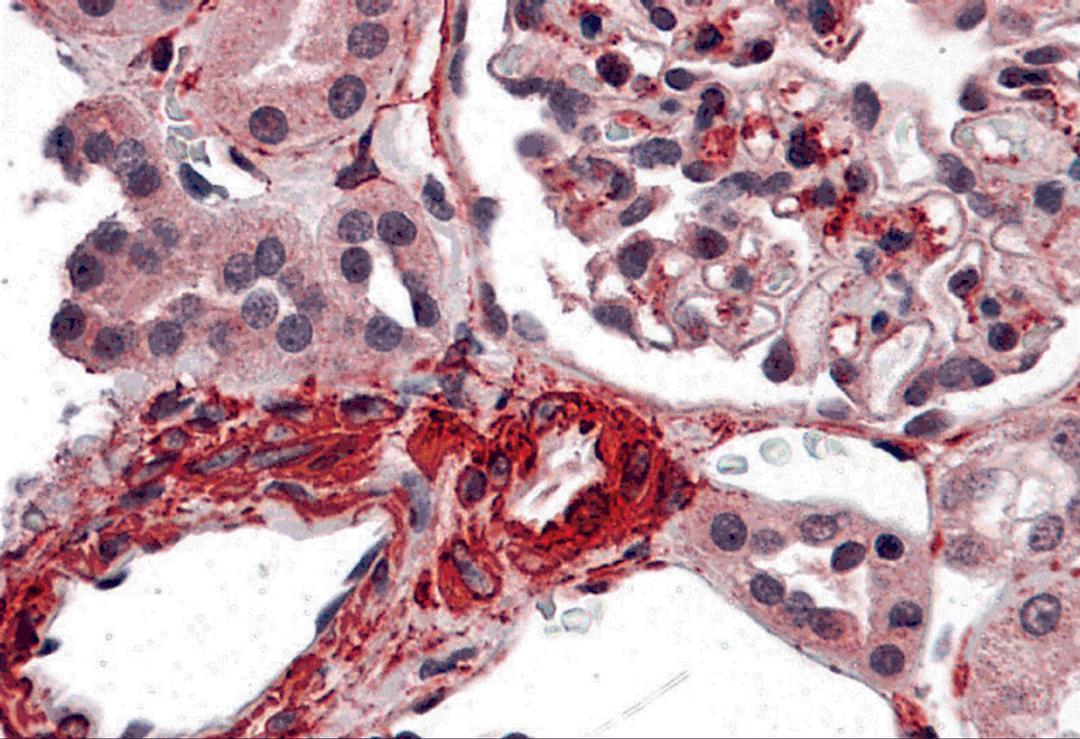 Immunohistochemistry of CARMA3 in human kidney tissue with CARMA3 antibody at 5 &#956;g/ml