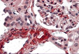 Immunohistochemistry of CARMA3 in human kidney tissue with CARMA3 antibody at 5 &#956;g/ml