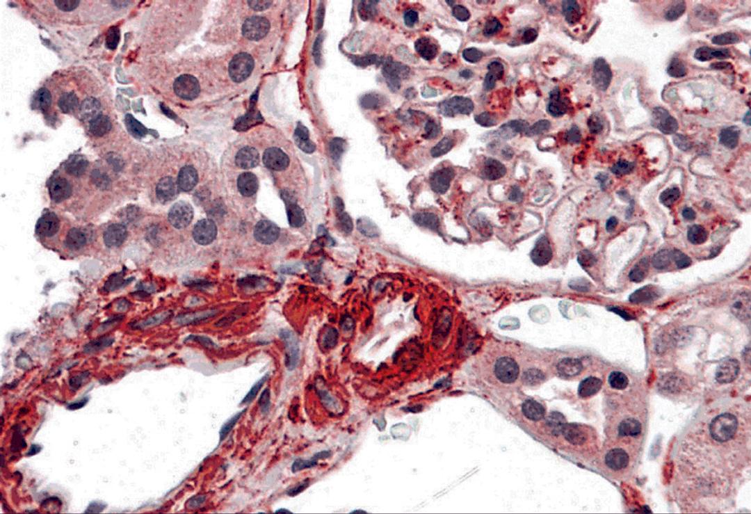 Immunohistochemistry of CARMA3 in human kidney tissue with CARMA3 antibody at 5 μg/ml
