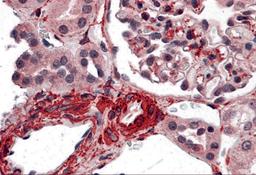 Immunohistochemistry of CARMA3 in human kidney tissue with CARMA3 antibody at 5 μg/ml