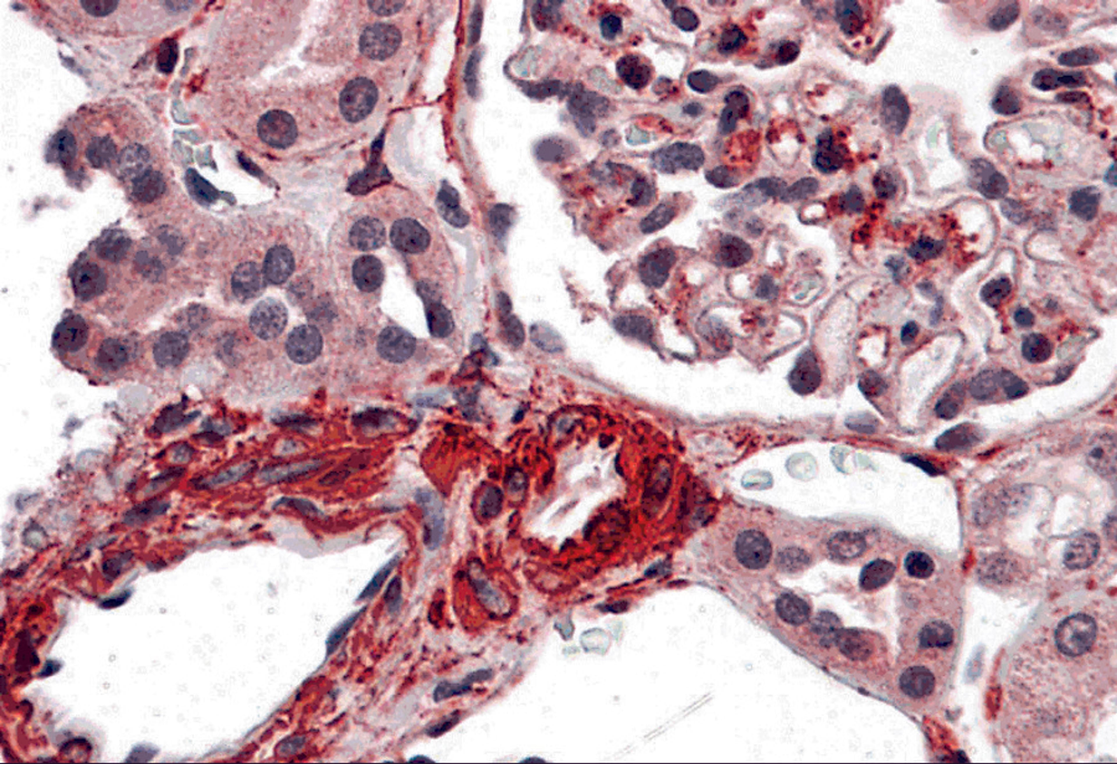 Immunohistochemistry of CARMA3 in human kidney tissue with CARMA3 antibody at 5 μg/ml
