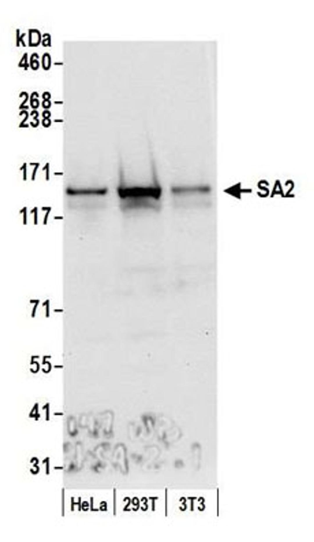 Detection of human and mouse SA2 by western blot.