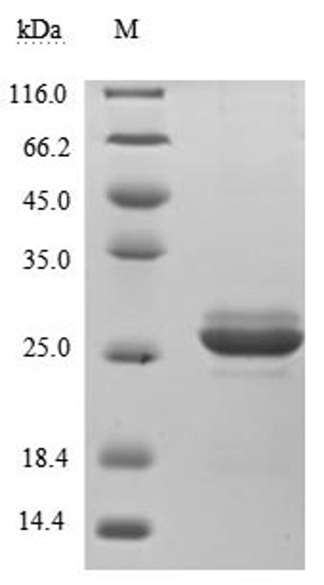 (Tris-Glycine gel) Discontinuous SDS-PAGE (reduced) with 5% enrichment gel and 15% separation gel.