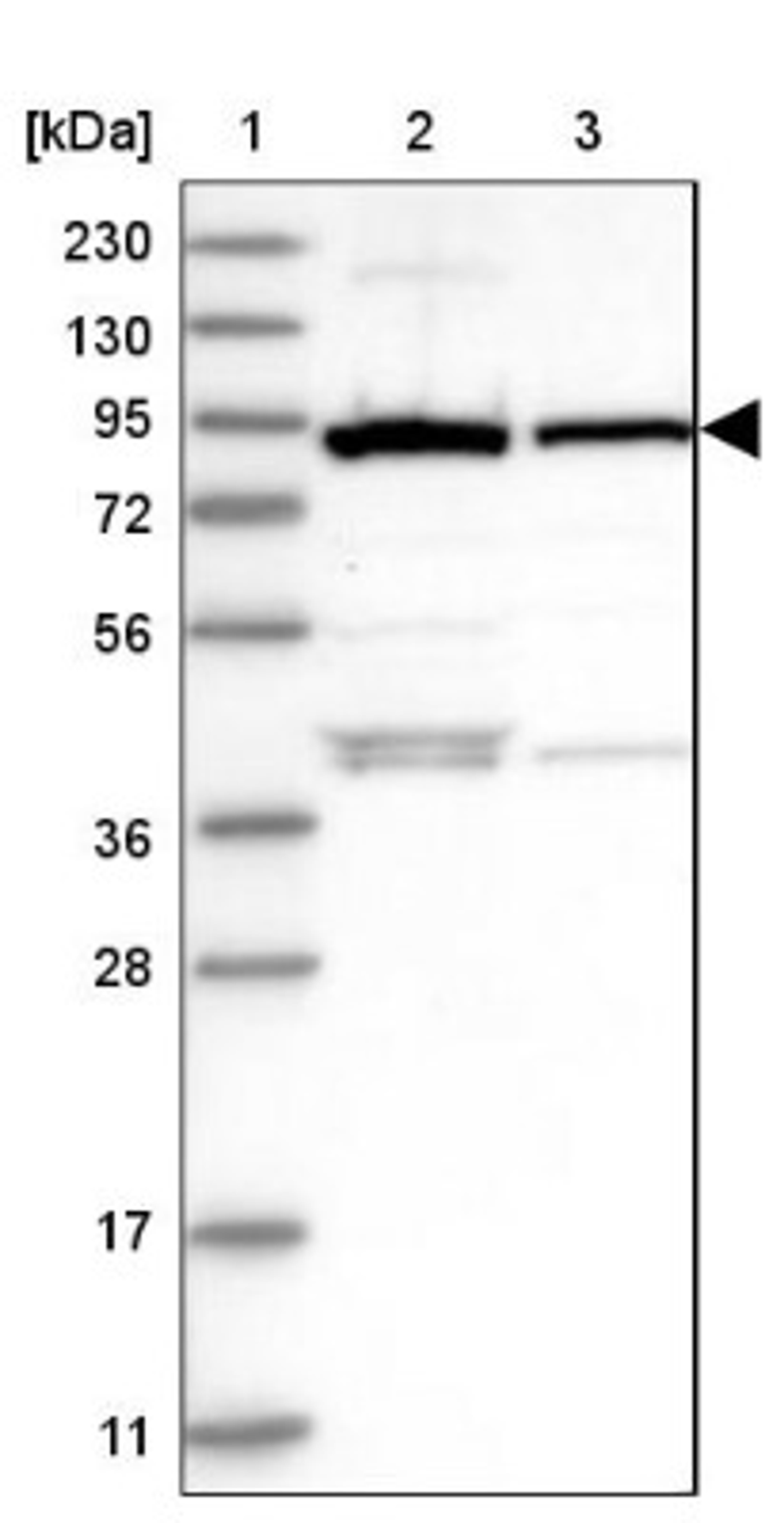 Western Blot: UFL1 Antibody [NBP1-90691] - Lane 1: Marker [kDa] 230, 130, 95, 72, 56, 36, 28, 17, 11<br/>Lane 2: Human cell line RT-4<br/>Lane 3: Human cell line U-251MG sp