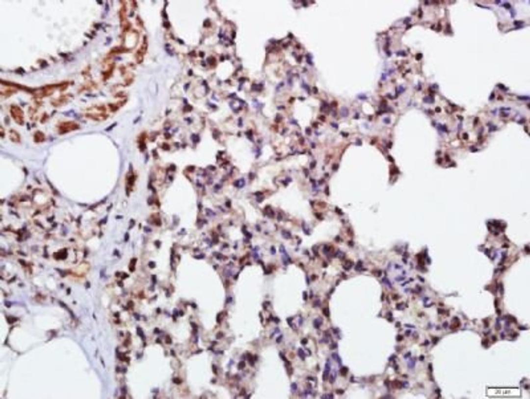 Immunohistochemical staining of Rat lung tissue using Endomucin antibody.