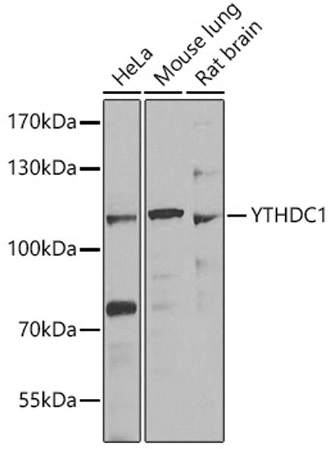 Western blot - YTHDC1 antibody (A7318)