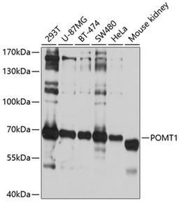 Western blot - POMT1 antibody (A10281)