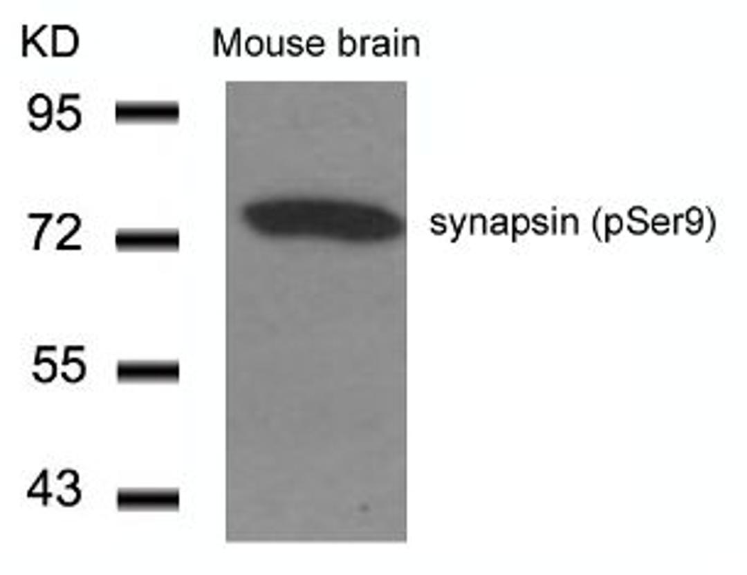 Western blot analysis of lysed extracts from Mouse Brain tissue using synapsin (Phospho-Ser9).