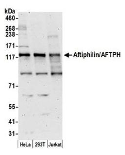 Detection of human Aftiphilin/AFTPH by western blot.