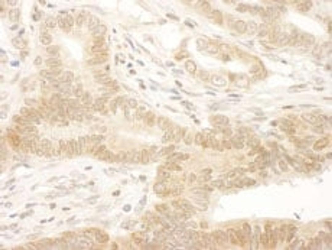 Detection of human NARG1 by immunohistochemistry.