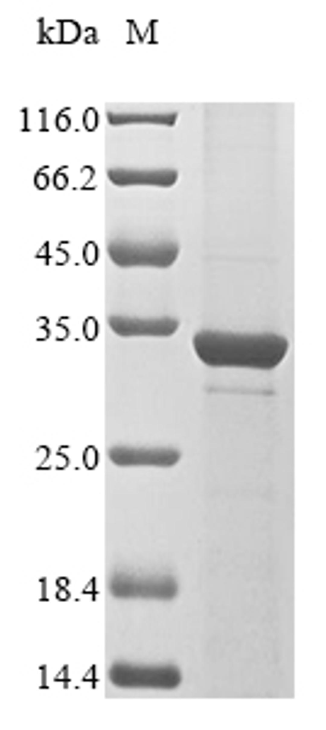 (Tris-Glycine gel) Discontinuous SDS-PAGE (reduced) with 5% enrichment gel and 15% separation gel.