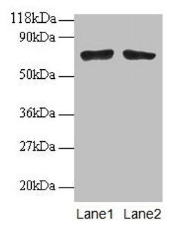 Western blot. All lanes: BMI1 antibodyt 2µg/ml. Lane 1: EC109 whole cell lysate. Lane 2: 293T whole cell lysate. Secondary. Goat polyclonal to rabbit IgG at 1/15000 dilution. Predicted band size: 37 kDa. Observed band size: 70 kDa