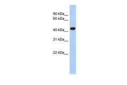 Antibody used in WB on Human Pancreas at 0.2-1 ug/ml.