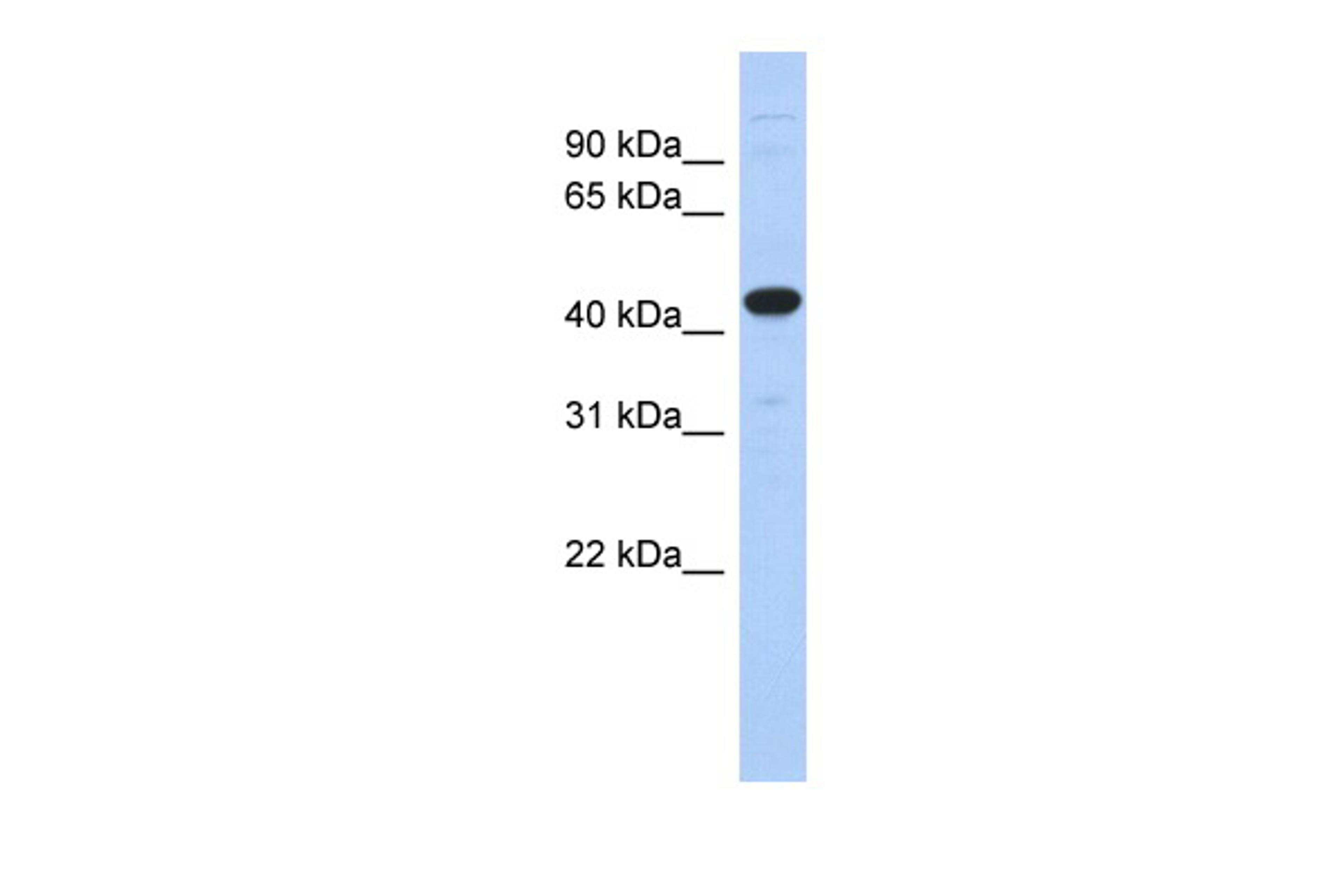 Antibody used in WB on Human Pancreas at 0.2-1 ug/ml.