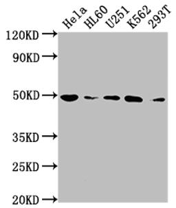 Western Blot. Positive WB detected in: Hela whole cell lysate, HL60 whole cell lysate, U251 whole cell lysate, K562 whole cell lysate, 293T whole cell lysate. All lanes: HDAC3 antibody at 1:2000. Secondary. Goat polyclonal to rabbit IgG at 1/50000 dilution. Predicted band size: 49, 50 kDa. Observed band size: 49 kDa.