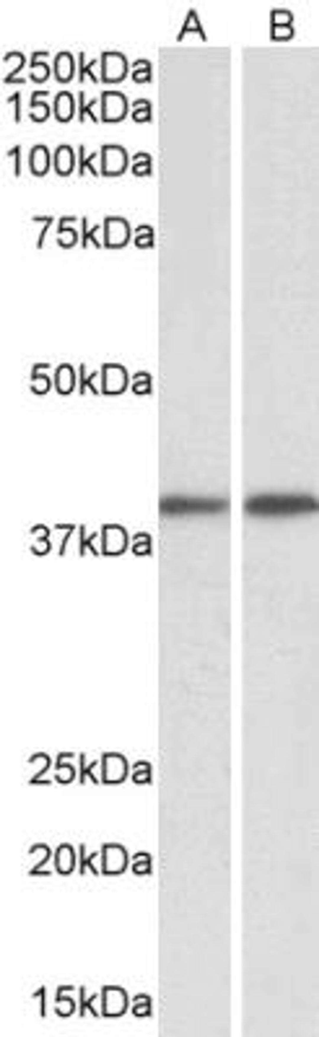 Western Blot: GNAQ Antibody [NBP1-72047] - Staining of Mouse (A) and Rat (B) Testis lysates (35 ug protein in RIPA buffer). Primary incubation was 1 hour. Detected by chemiluminescence.