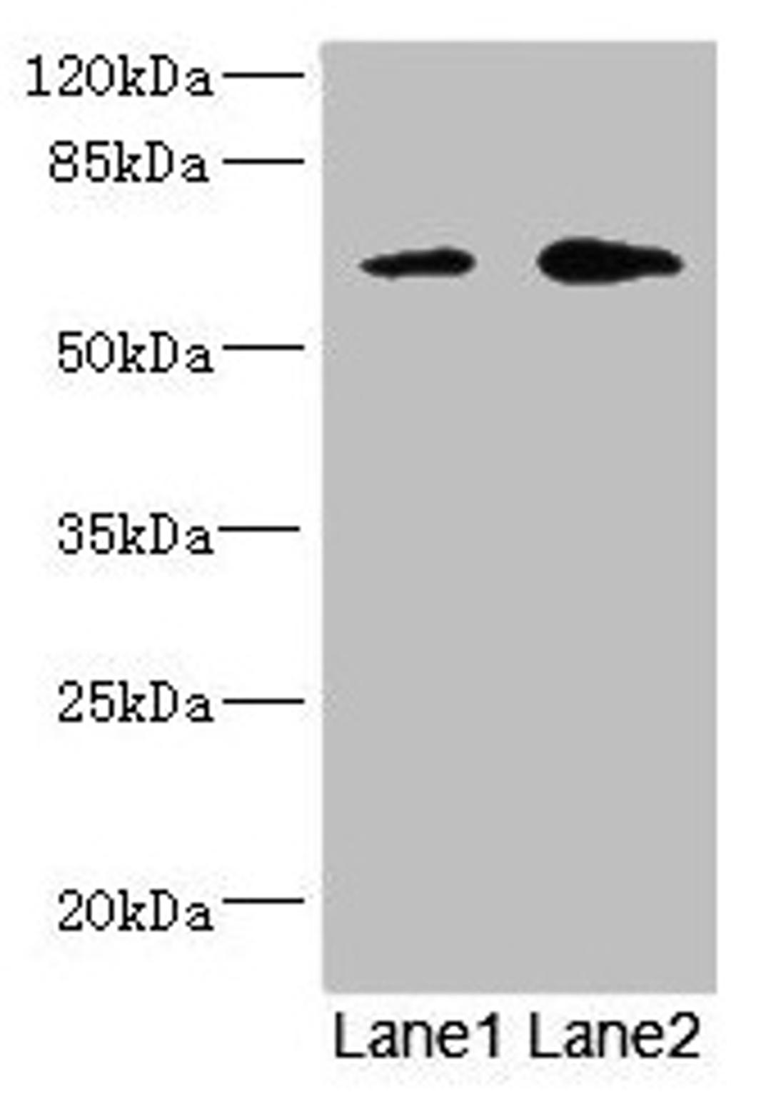 Western blot. All lanes: REC8 antibody at 1.67µg/ml. Lane 1: Jurkat whole cell lysate. Lane 2: HT29 whole cell lysate. Secondary. Goat polyclonal to rabbit IgG at 1/10000 dilution. Predicted band size: 63, 61 kDa. Observed band size: 63 kDa