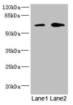 Western blot. All lanes: REC8 antibody at 1.67µg/ml. Lane 1: Jurkat whole cell lysate. Lane 2: HT29 whole cell lysate. Secondary. Goat polyclonal to rabbit IgG at 1/10000 dilution. Predicted band size: 63, 61 kDa. Observed band size: 63 kDa