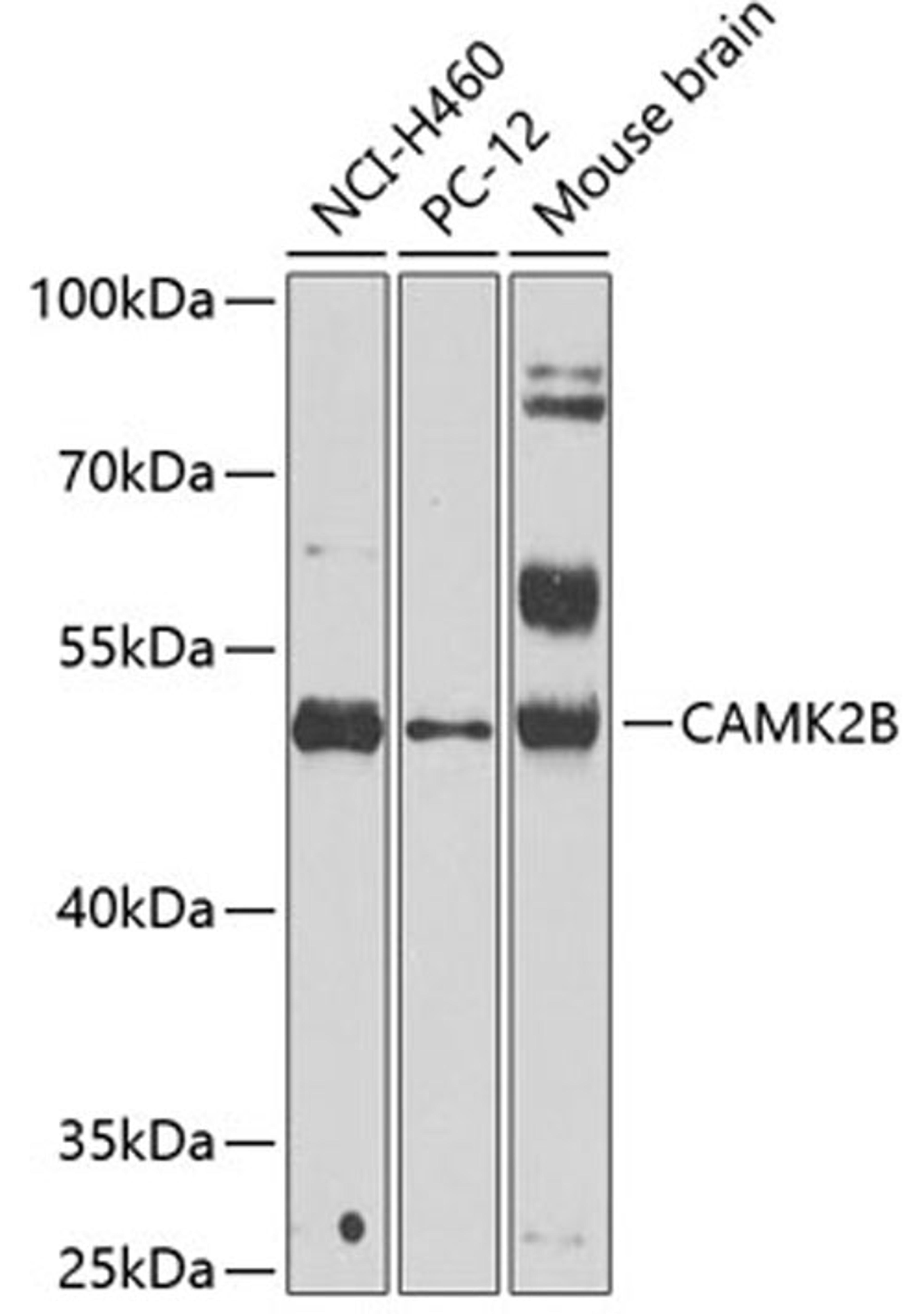 Western blot - CAMK2B antibody (A2508)