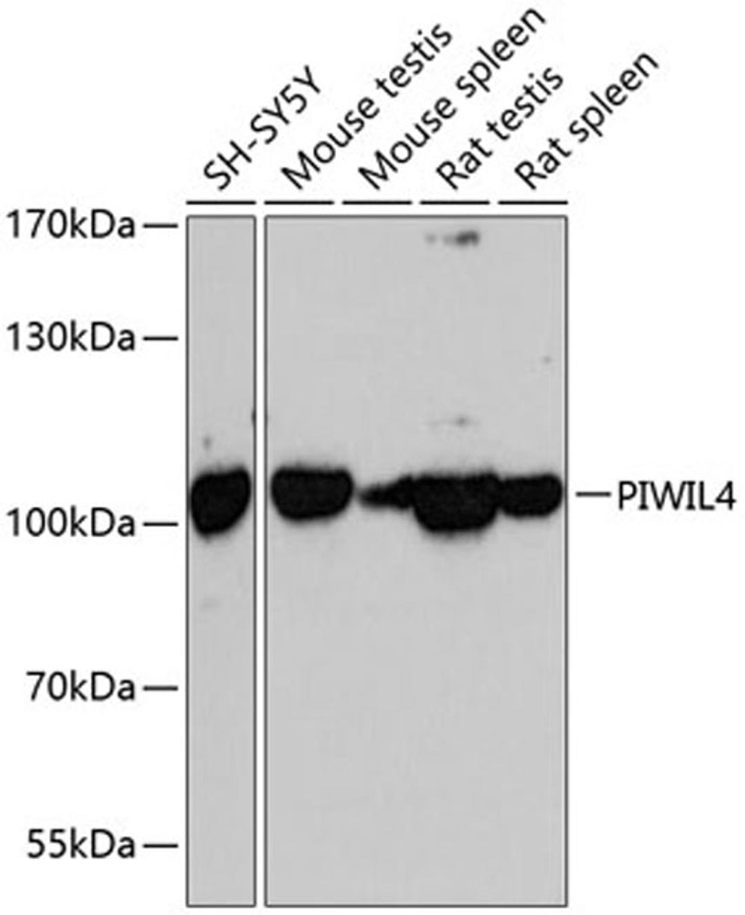 Western blot - PIWIL4 antibody (A13201)